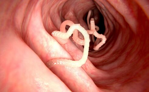 Würmer am mënschleche Kierper