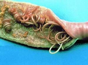 D'Ursaachen vun de Parasiten am mënschleche Kierper