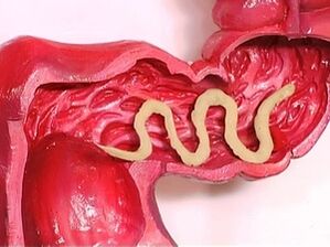 Parasiten am mënschleche Kierper firwat se optrieden
