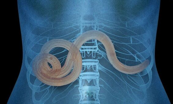 Parasit am mënschleche Kierper