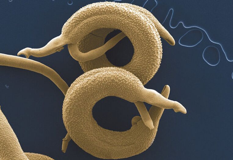 Parasiten, déi am mënschleche Kierper liewen