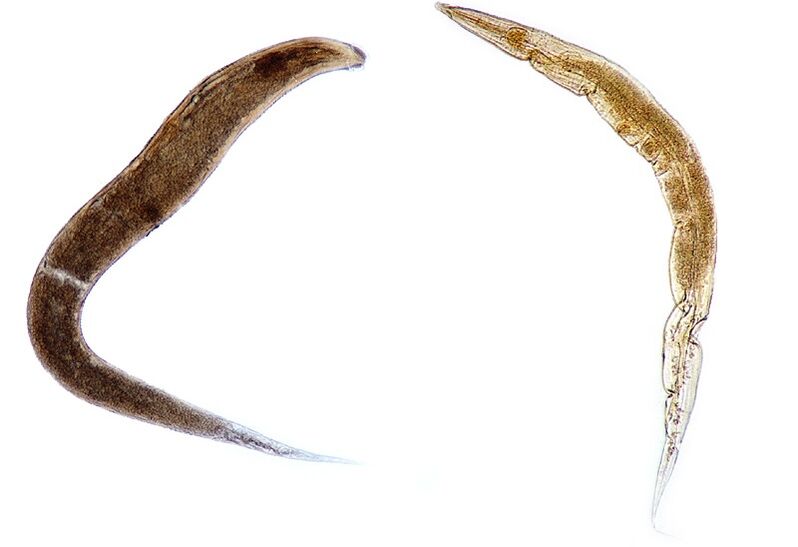 Pinworms am Kierper vun de Kanner