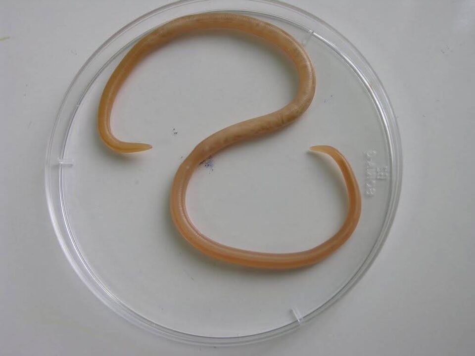 wéi gesinn Parasiten bei Kanner aus